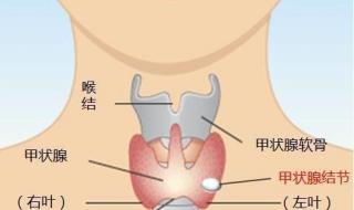 甲状腺结节怎么治疗